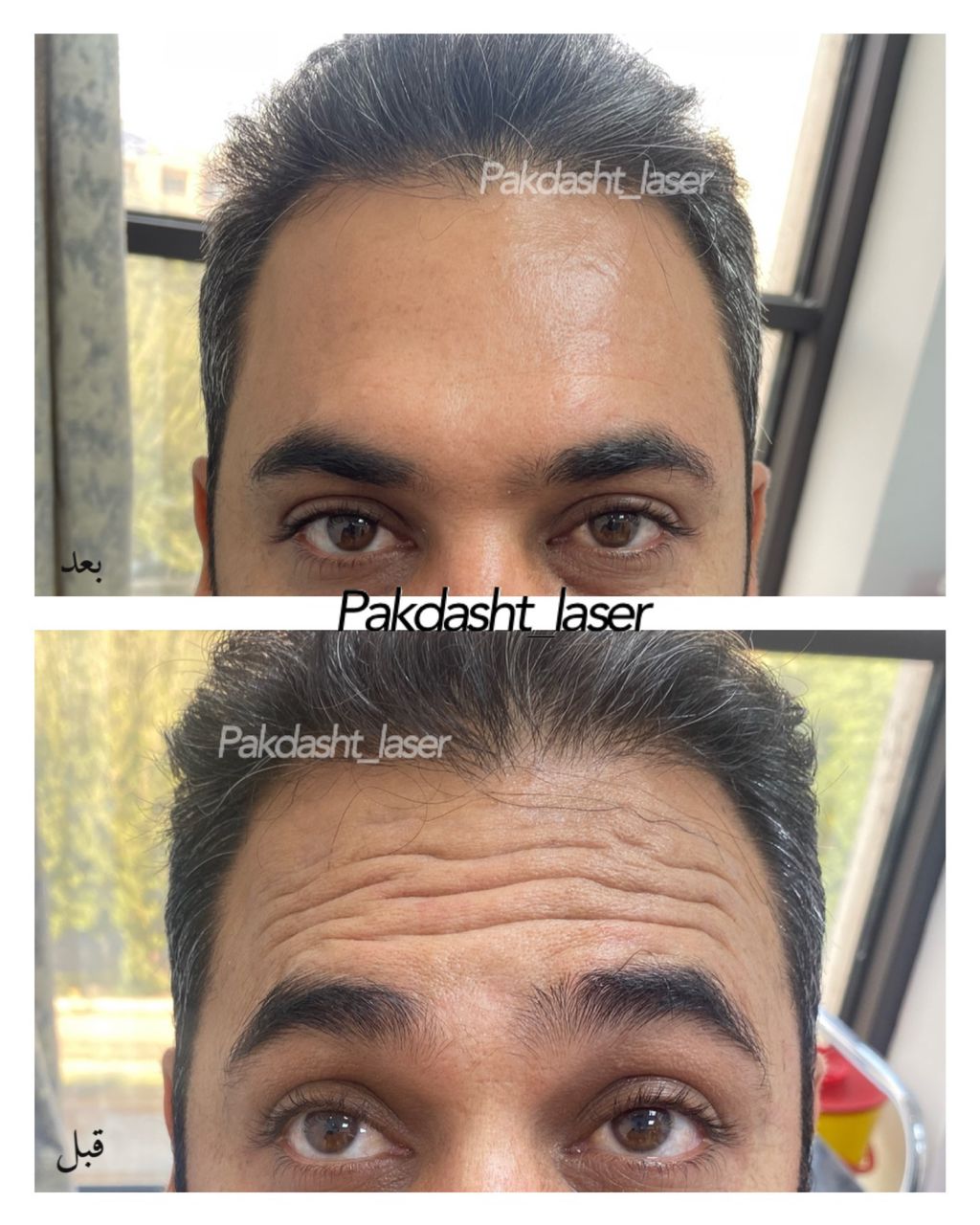 خدمات کلینیک پاکدشت لیزر