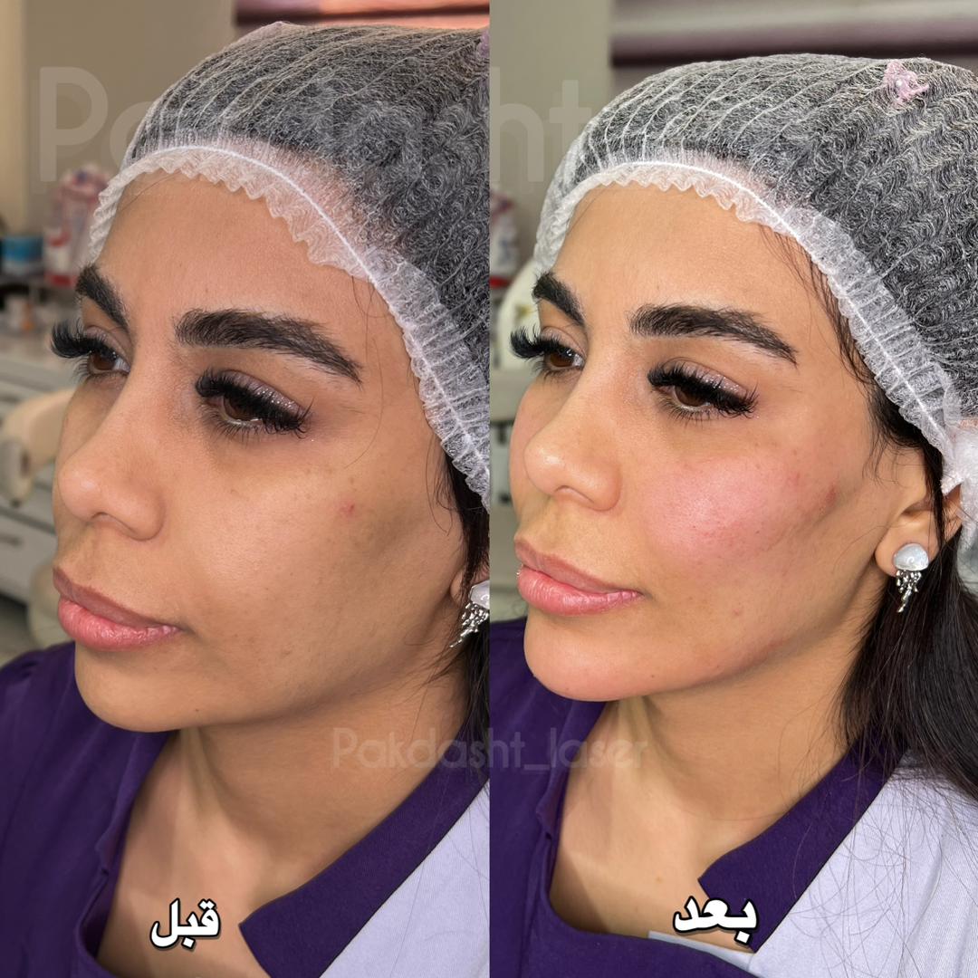 خدمات کلینیک پاکدشت لیزر