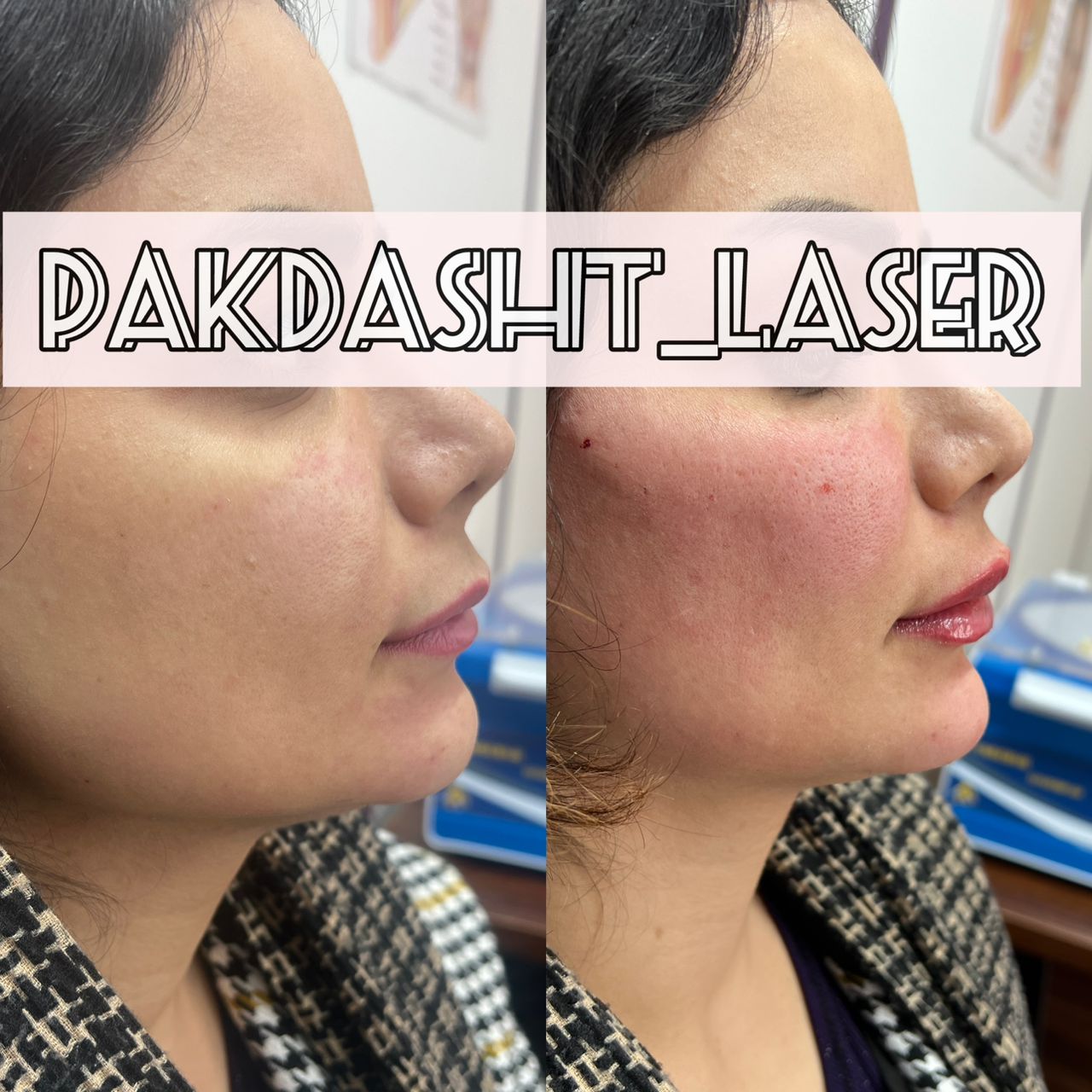 نتیجه را ببینید...!