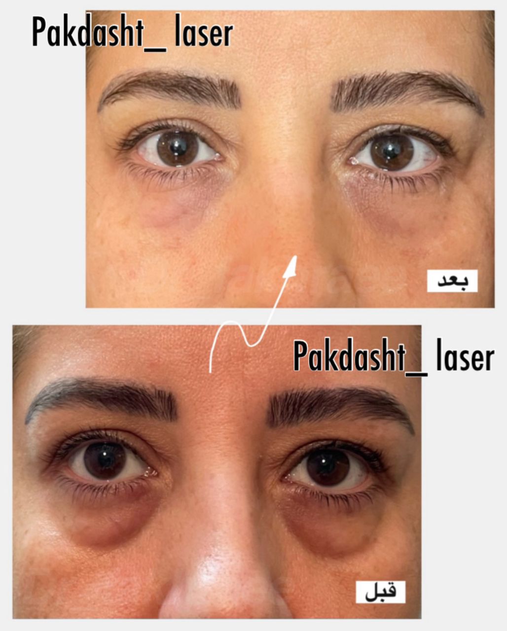 خدمات کلینیک پاکدشت لیزر