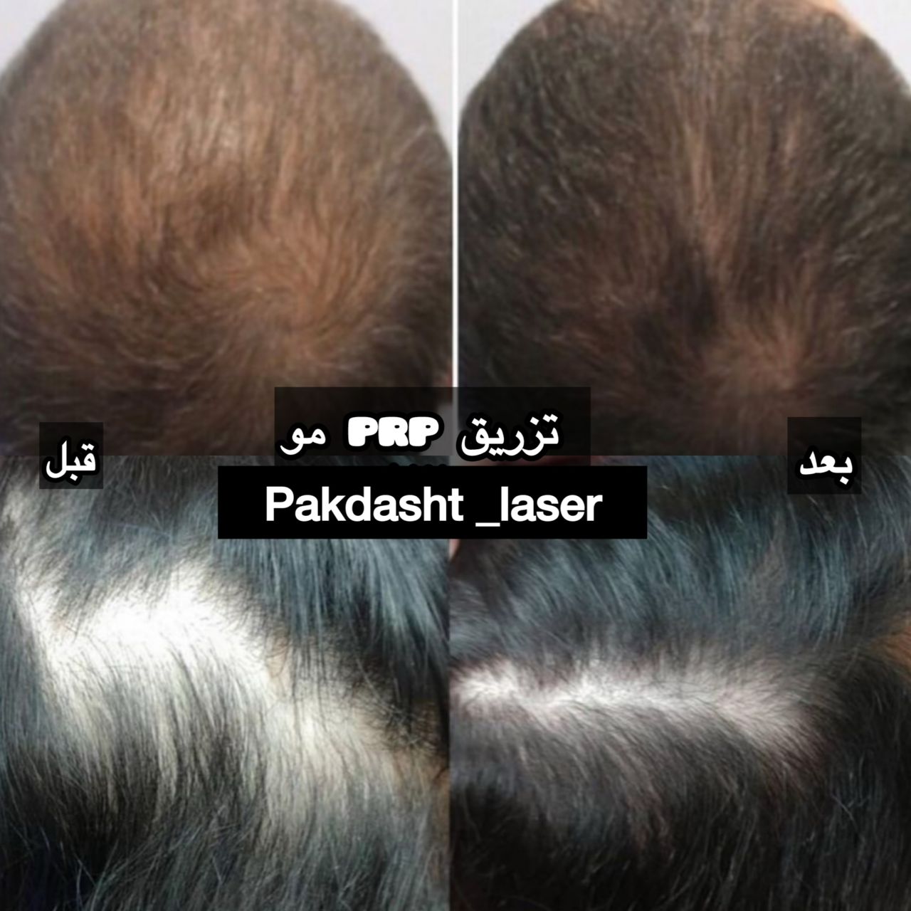 خدمات کلینیک پاکدشت لیزر