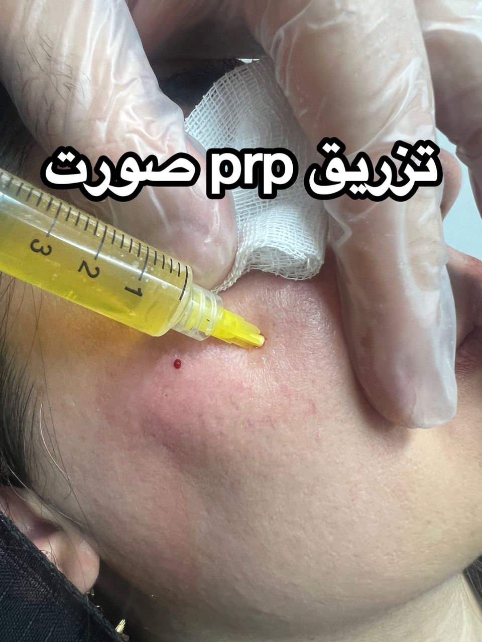 خدمات کلینیک پاکدشت لیزر