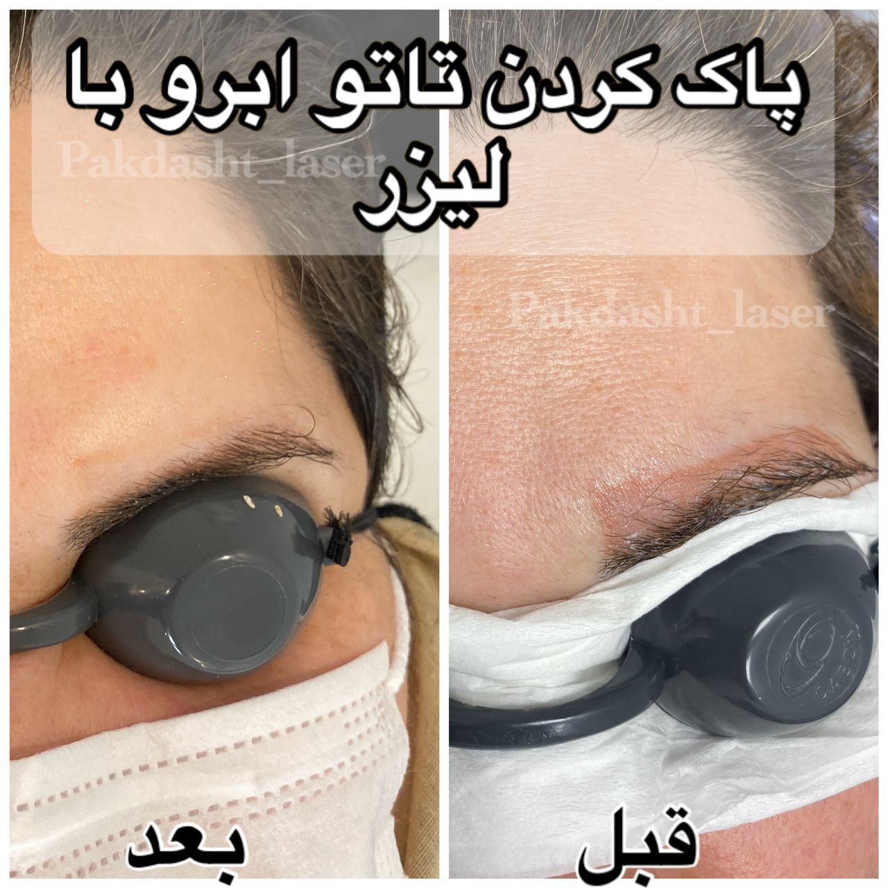 خدمات کلینیک پاکدشت لیزر